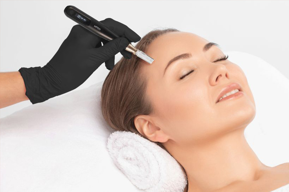 Microneedling Behandlung im Beautyfashion Odelzhausen für glatte, strahlende Haut